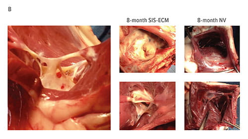 Fig B:  : Visual examination indicated that SIS-ECM valves appeared similar to native valves (NV). This valve displays signs of chord formation, tendons that connect the valve to heart muscle.